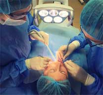 Interventie implantologie